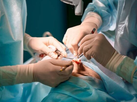 Trauma Surgery – Types, Preparation, Procedure, Risks and Complications