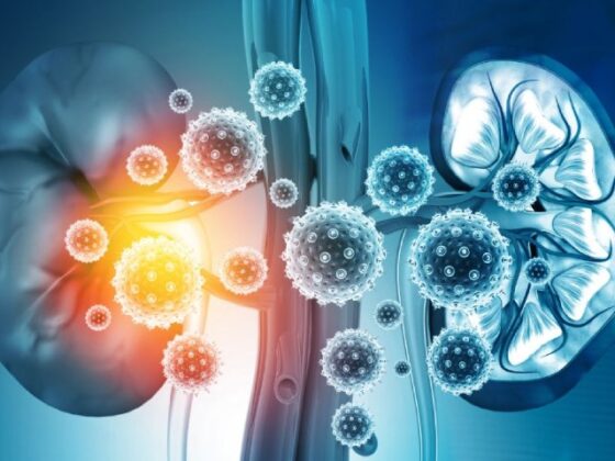 Acute Kidney Injury: Recognizing the Signs
