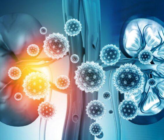 Acute Kidney Injury: Recognizing the Signs