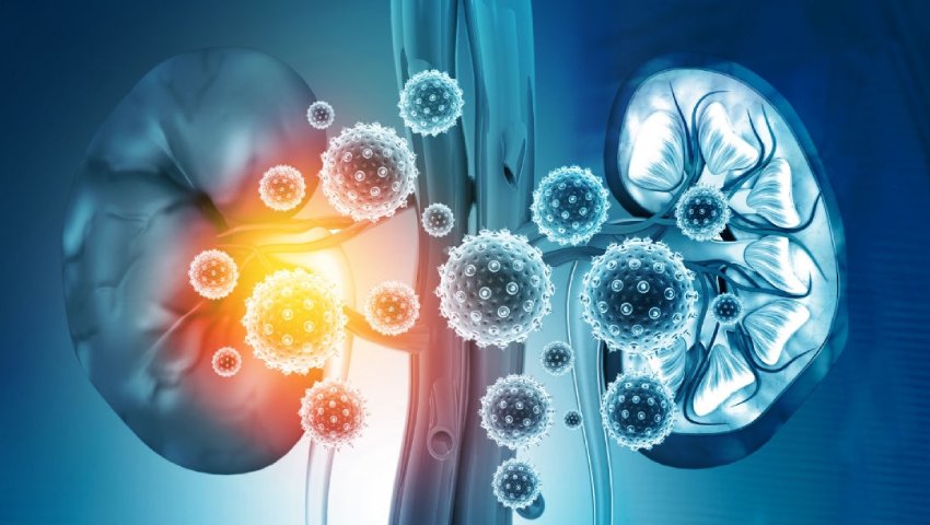 Doctor explaining symptoms and treatment of acute kidney injury at Apex Hospital – best care for acute renal failure