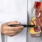 Best piles doctor in PCMC, Pune – Apex Hospital piles specialist for laser piles surgery and 24/7 emergency piles hospital in Pimpri Chinchwad