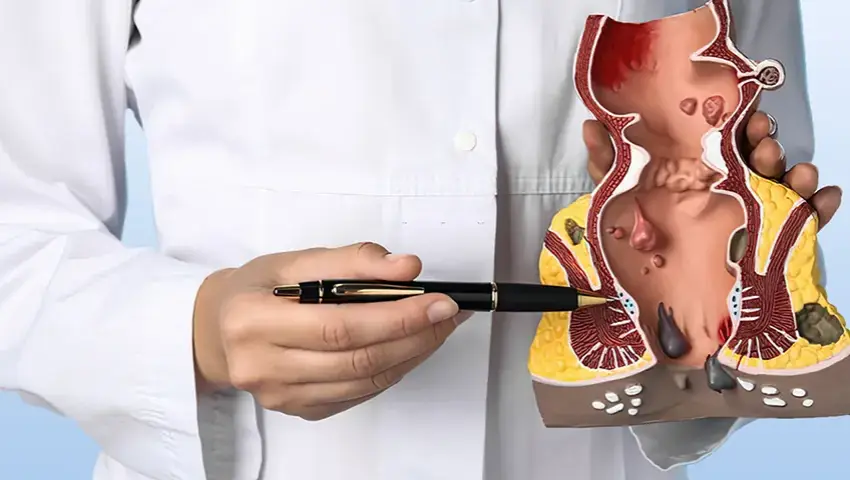 Best piles doctor in PCMC, Pune – Apex Hospital piles specialist for laser piles surgery and 24/7 emergency piles hospital in Pimpri Chinchwad