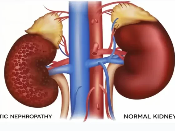 Early Warning Signs of Kidney Damage in Diabetes Patients You Shouldn’t Ignore