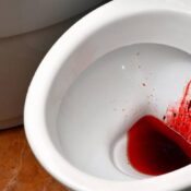 Blood in stool warning sign showing fresh red blood in toilet bowl