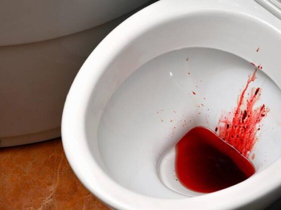 Blood in Stool: When It’s a Warning Sign for Piles or Something Serious?