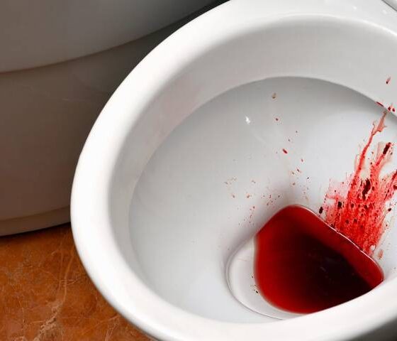 Blood in Stool: When It’s a Warning Sign for Piles or Something Serious?