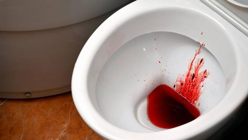 Blood in stool warning sign showing fresh red blood in toilet bowl