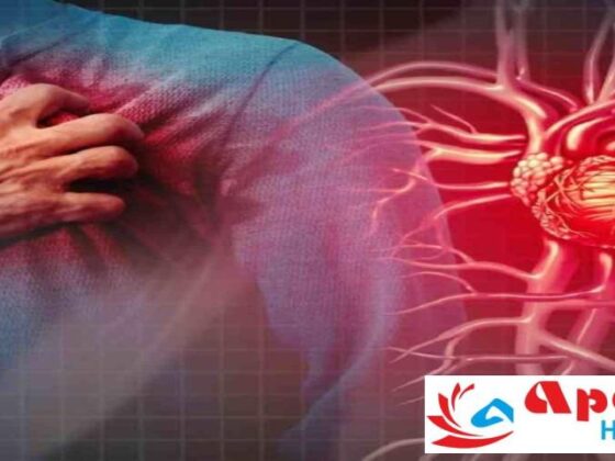 Chest Pain: Heart-Related or Gas Problem