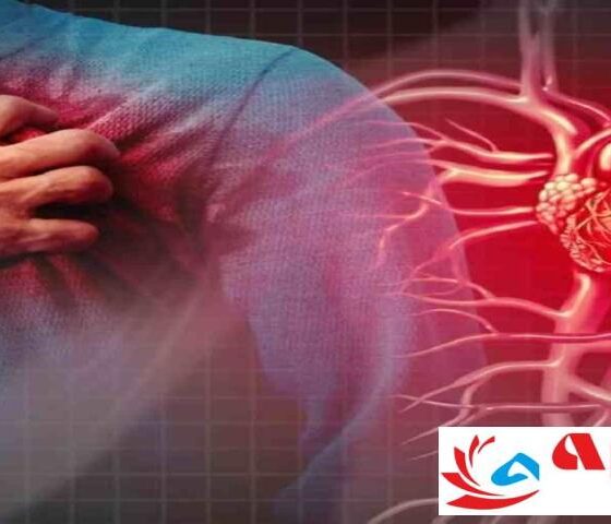 Chest Pain: Heart-Related or Gas Problem