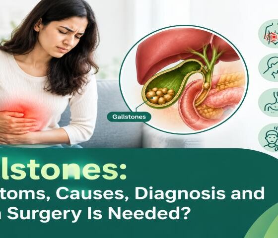 Gallstones: Symptoms, Causes, Diagnosis and When Surgery Is Needed?